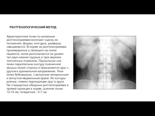 РЕНТГЕНОЛОГИЧЕСКИЙ МЕТОД Характеристика почек по нативным рентгенограммам включает оценку их