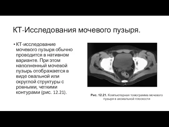 КТ-Исследования мочевого пузыря. КТ-исследование мочевого пузыря обычно проводится в нативном