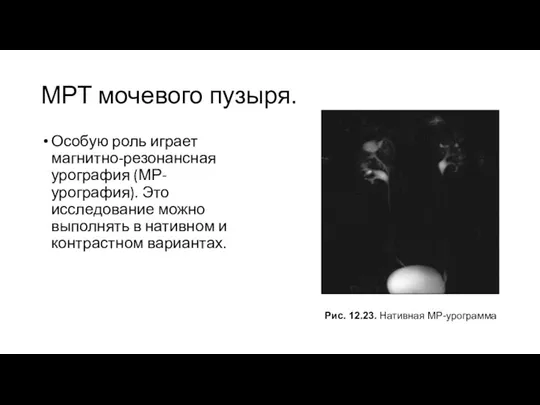 МРТ мочевого пузыря. Особую роль играет магнитно-резонансная урография (МР-урография). Это