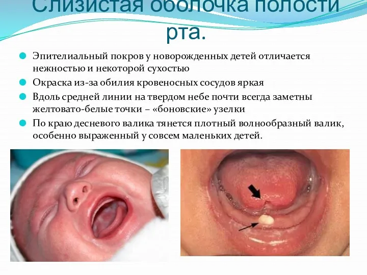 Слизистая оболочка полости рта. Эпителиальный покров у новорожденных детей отличается нежностью и некоторой