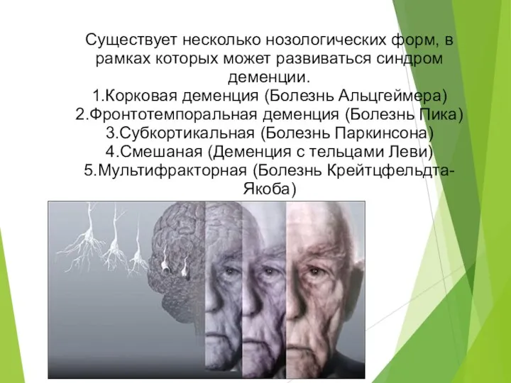 Существует несколько нозологических форм, в рамках которых может развиваться синдром деменции. 1.Корковая деменция