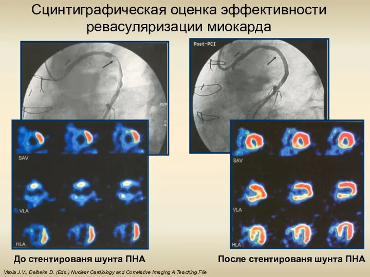 Vitola J.V., Delbeke D. (Eds.) Nuclear Cardiology and Correlative Imaging
