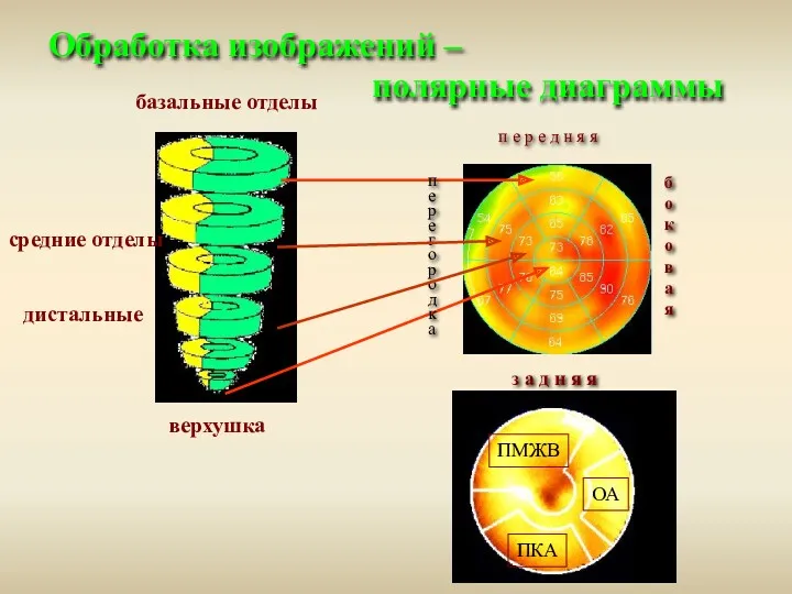 Обработка изображений – полярные диаграммы ОА ПКА ПМЖВ ПКА ОА ПМЖВ средние отделы дистальные