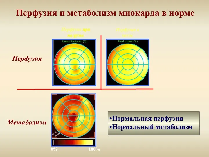 Перфузия и метаболизм миокарда в норме