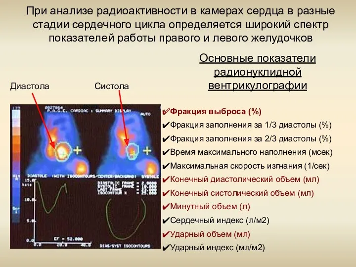 Диастола Систола При анализе радиоактивности в камерах сердца в разные