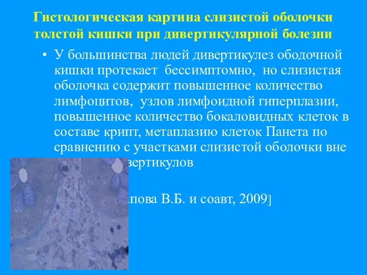 Гистологическая картина слизистой оболочки толстой кишки при дивертикулярной болезни У