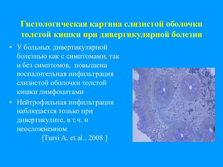 Гистологическая картина слизистой оболочки толстой кишки при дивертикулярной болезни У