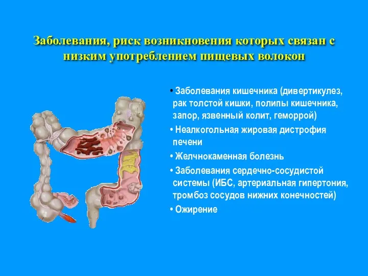 Заболевания, риск возникновения которых связан с низким употреблением пищевых волокон