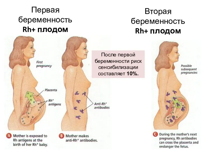 Первая беременность Rh+ плодом Вторая беременность Rh+ плодом После первой беременности риск сенсибилизации составляет 10%.
