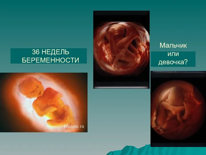 36 НЕДЕЛЬ БЕРЕМЕННОСТИ Мальчик или девочка?