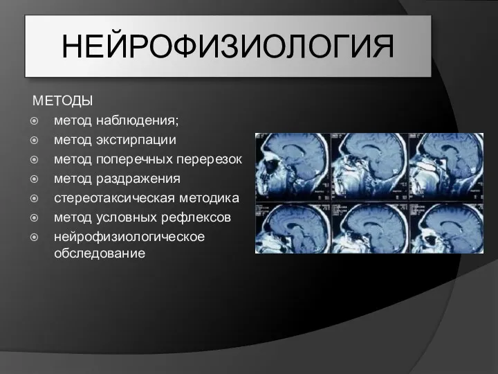 НЕЙРОФИЗИОЛОГИЯ МЕТОДЫ метод наблюдения; метод экстирпации метод поперечных перерезок метод раздражения стереотаксическая методика