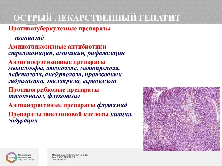 ОСТРЫЙ ЛЕКАРСТВЕННЫЙ ГЕПАТИТ Противотуберкулезные препараты изониазид Аминогликозидные антибиотики стрептомицин, амикацин,