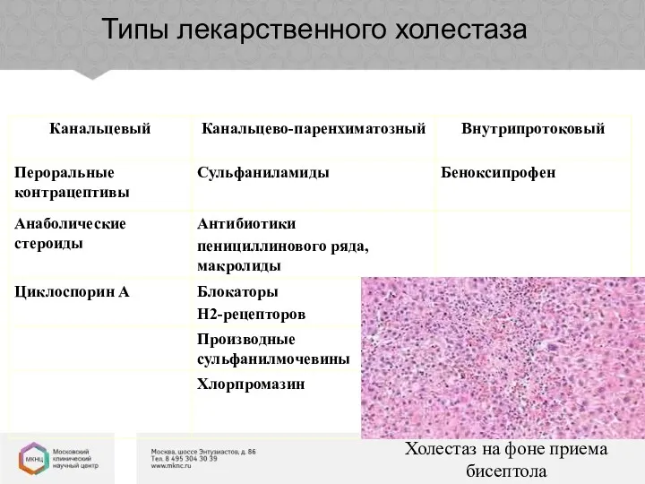 Типы лекарственного холестаза Холестаз на фоне приема бисептола