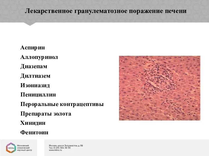 Лекарственное гранулематозное поражение печени Аспирин Аллопуринол Диазепам Дилтиазем Изониазид Пенициллин Пероральные контрацептивы Препараты золота Хинидин Фенитоин