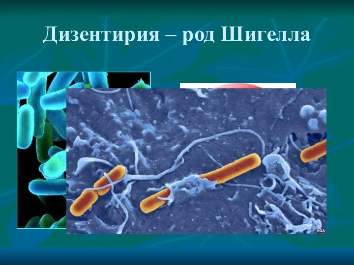 Дизентирия – род Шигелла