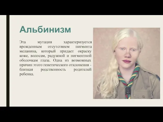 Альбинизм Эта мутация характеризуется врожденным отсутствием пигмента меланина, который придает