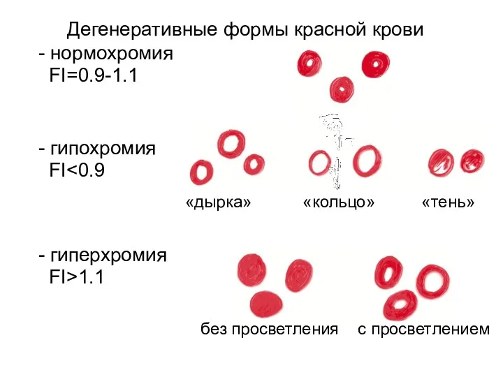 Дегенеративные формы красной крови - нормохромия FI=0.9-1.1 - гипохромия FI