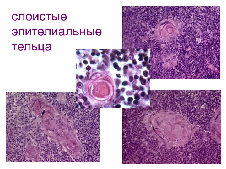 слоистые эпителиальные тельца