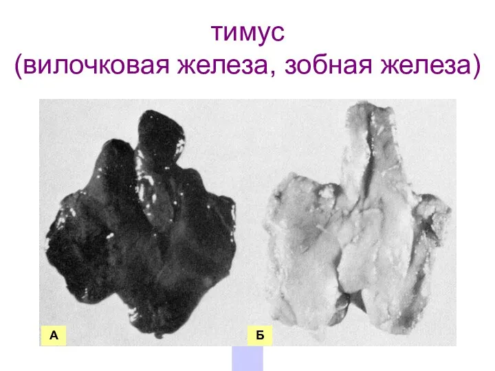 Тимус макропрепараты тимус (вилочковая железа, зобная железа) А Б