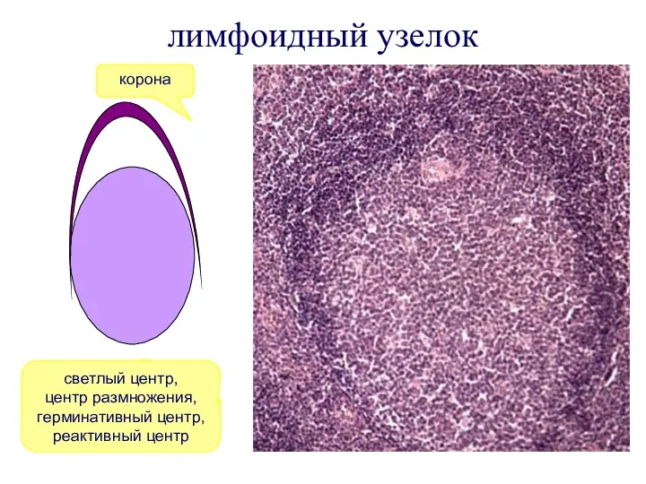 лимфоидный узелок светлый центр, центр размножения, герминативный центр, реактивный центр корона корона