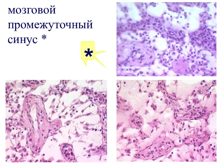 * мозговой промежуточный синус *