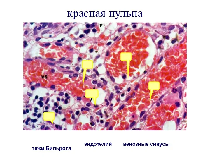 красная пульпа 1 1 1 тяжи Бильрота эндотелий венозные синусы