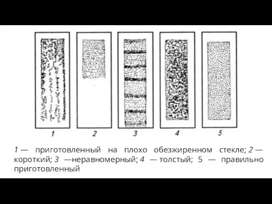 1 — приготовленный на плохо обезжиренном стекле; 2 — короткий;