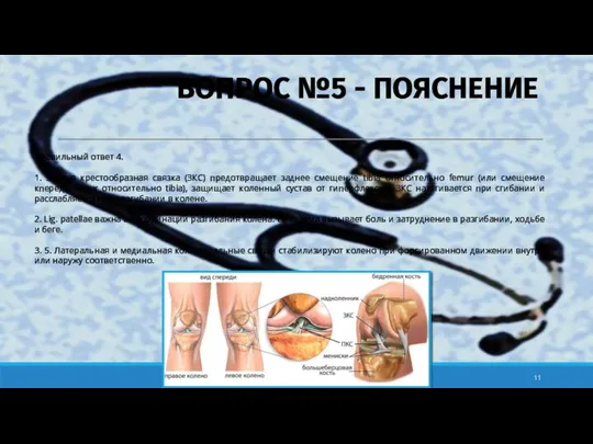 Правильный ответ 4. 1. Задняя крестообразная связка (ЗКС) предотвращает заднее