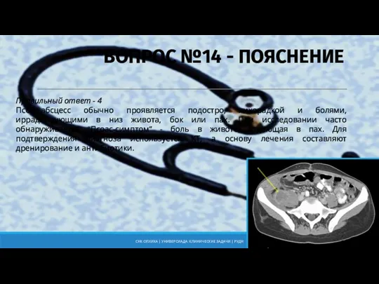 Правильный ответ - 4 Псоас-абсцесс обычно проявляется подостро, лихорадкой и болями, иррадиирующими в