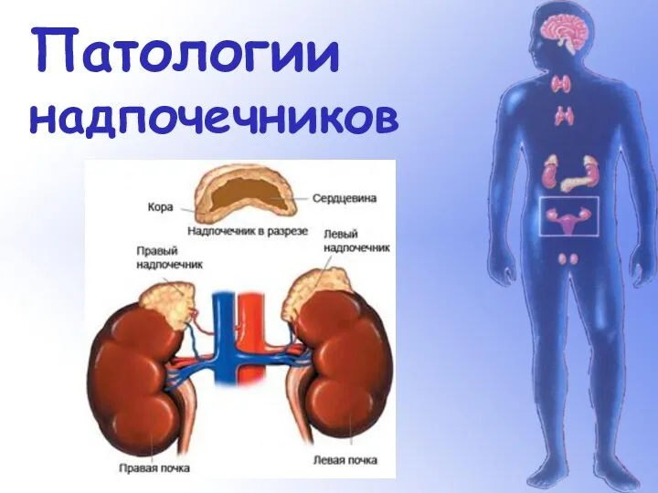 Патологии надпочечников