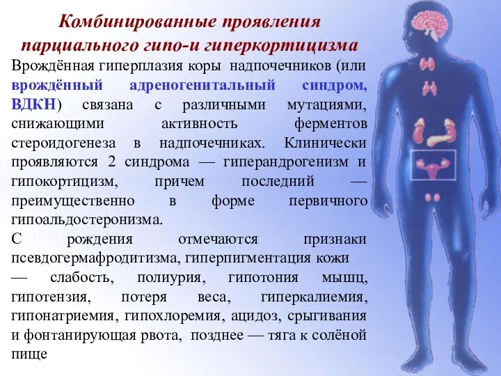 Комбинированные проявления парциального гипо-и гиперкортицизма Врождённая гиперплазия коры надпочечников (или