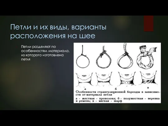 Петли и их виды, варианты расположения на шее Петли разделяют по особенностям материала,