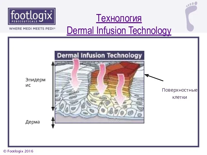 Эпидермис Дерма Поверхностные клетки Технология Dermal Infusion Technology