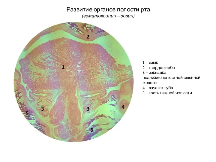 Развитие органов полости рта (гематоксилин – эозин) 1 – язык