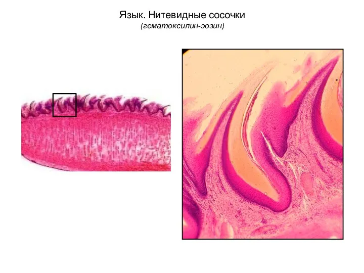 Язык. Нитевидные сосочки (гематоксилин-эозин)