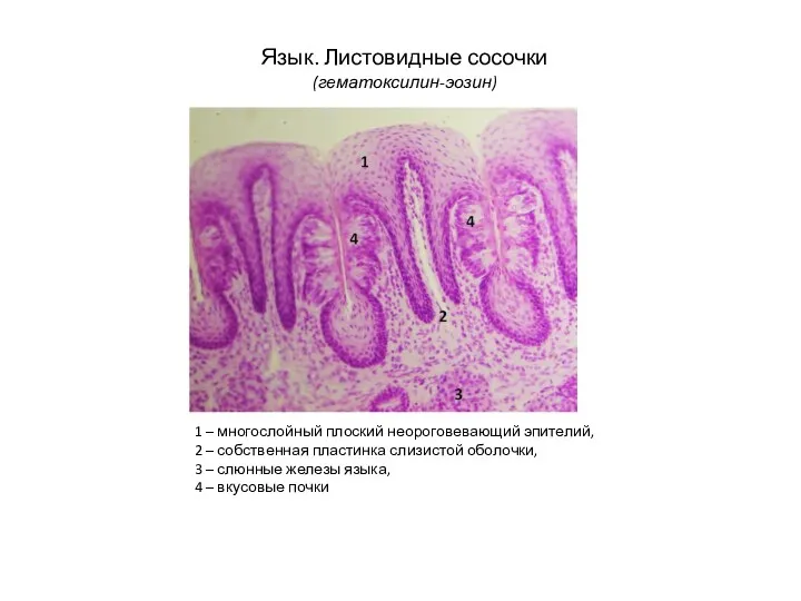 Язык. Листовидные сосочки (гематоксилин-эозин) 1 – многослойный плоский неороговевающий эпителий,