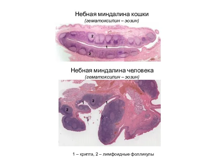 Небная миндалина человека (гематоксилин – эозин) 2 2 1 1