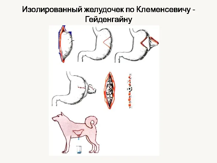 Изолированный желудочек по Клеменсевичу - Гейденгайну