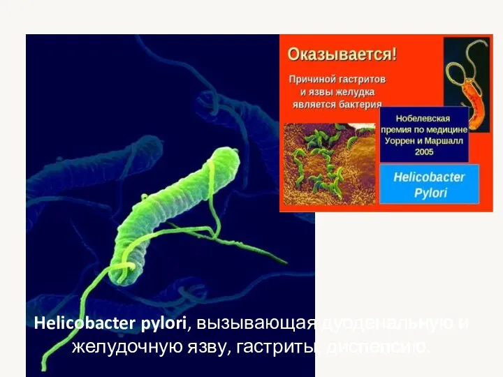 Helicobacter pylori, вызывающая дуоденальную и желудочную язву, гастриты, диспепсию.