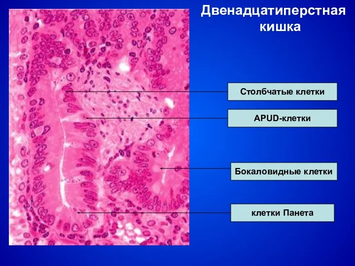 Двенадцатиперстная кишка АРUD-клетки клетки Панета Столбчатые клетки Бокаловидные клетки