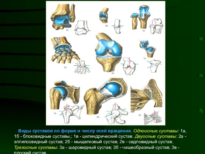 Виды суставов по форме и числу осей вращения. Одноосные суставы: 1а, 1б -