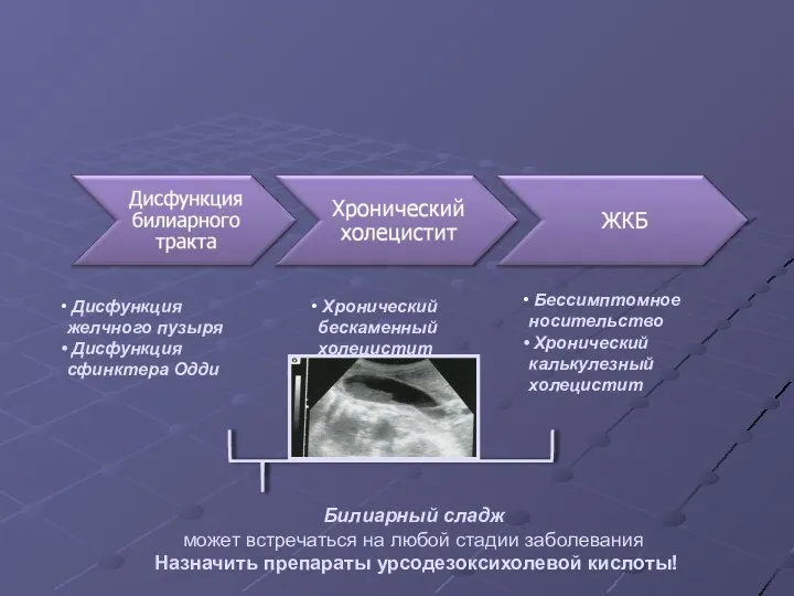 Дисфункция желчного пузыря Дисфункция сфинктера Одди Хронический бескаменный холецистит Бессимптомное