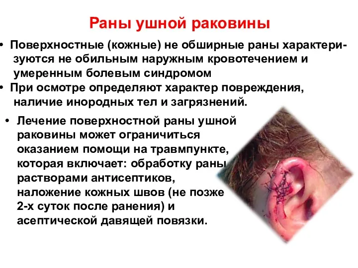 Раны ушной раковины Лечение поверхностной раны ушной раковины может ограничиться