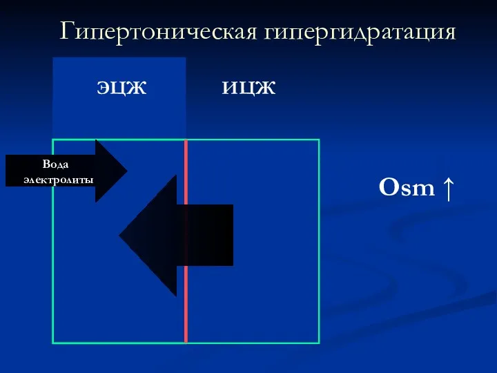 Гипертоническая гипергидратация ЭЦЖ ИЦЖ Osm ↑ Вода ⮘ электролиты