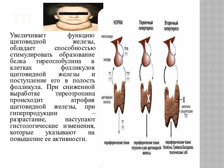 ТТГ Увеличивает функцию щитовидной железы, обладает способностью стимулировать образование белка