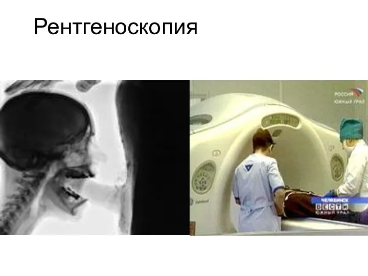 Рентгеноскопия