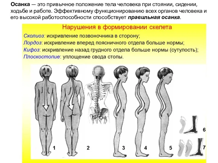 Осанка — это привычное положение тела человека при стоянии, сидении,