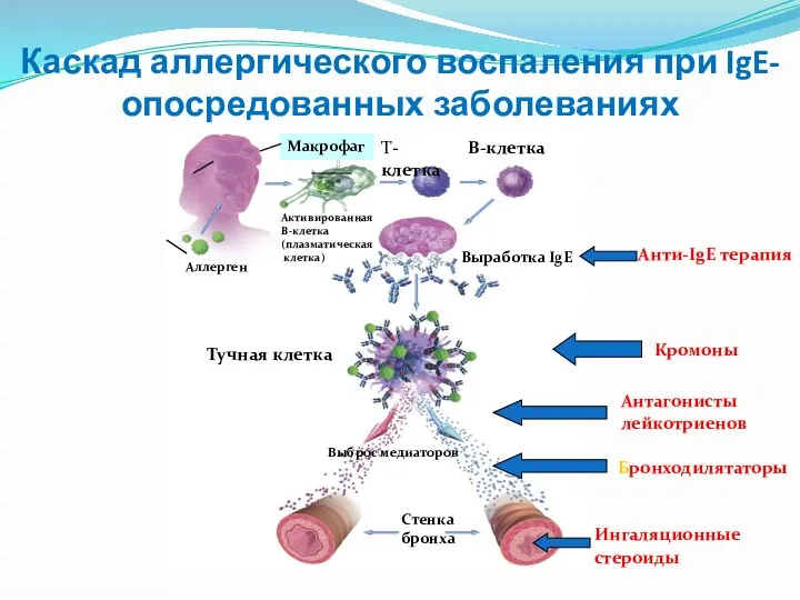 Каскад аллергического воспаления при IgE- опосредованных заболеваниях Выработка IgE T-клетка