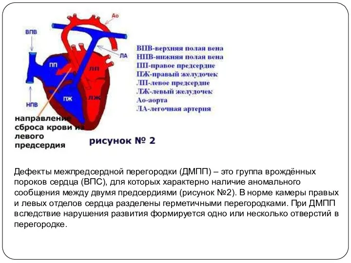 Дефекты межпредсердной перегородки (ДМПП) – это группа врождённых пороков сердца