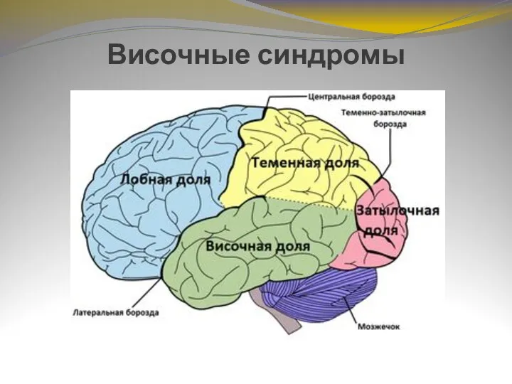 Височные синдромы